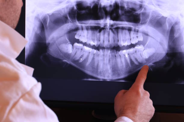 Best Emergency Dental Care for Sports Injuries in Selma, NC